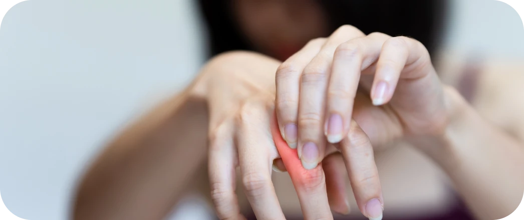 Hand & </br> Finger Pain-img